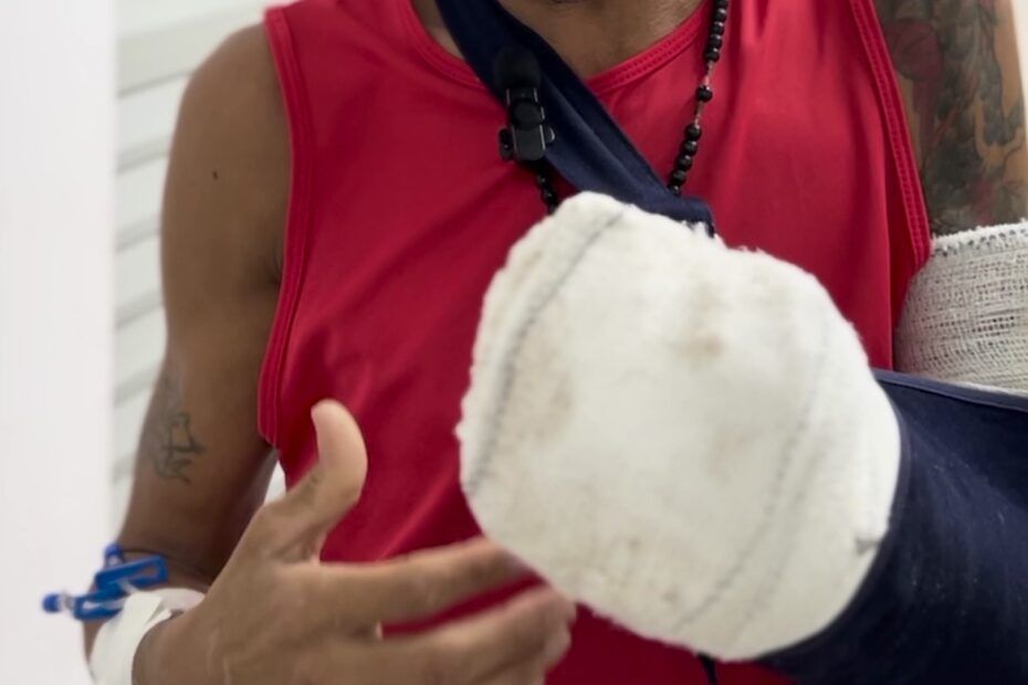 Reimplante de mão em Sergipe