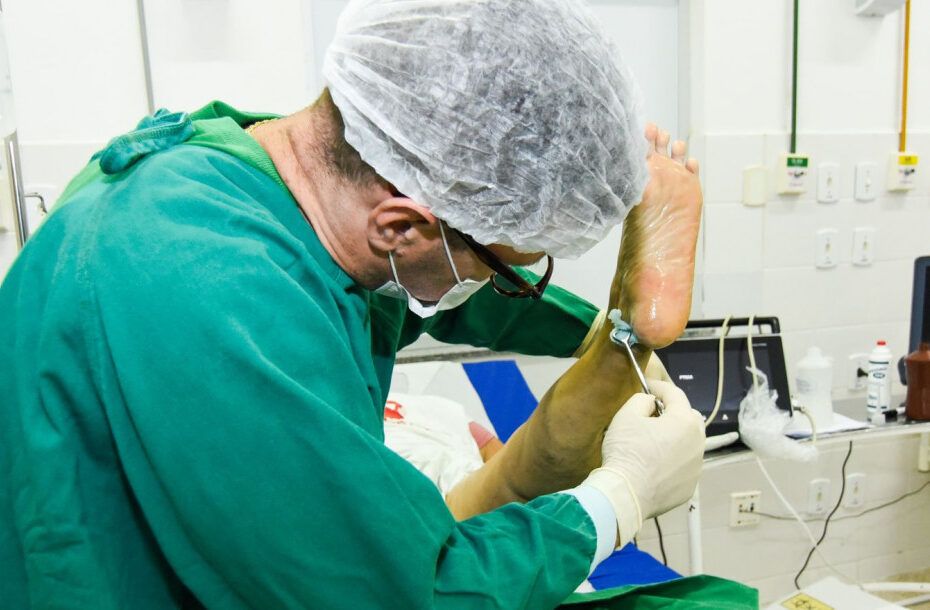 Mutirão de cirurgias de varizes em Sergipe amplia acesso à saúde e reduz filas de espera